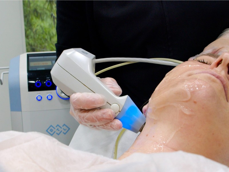 Treatment with BTL Exilis Elite in Iasi - reduces wrinkles, blurs dark circles and increases lip volume