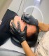 Ten de vedeta, cu tratamentul Microneedling, cu MicroPen, in Iasi