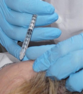 Redefine your beauty - Mesotherapy, PRP, and Botox in Bucharest