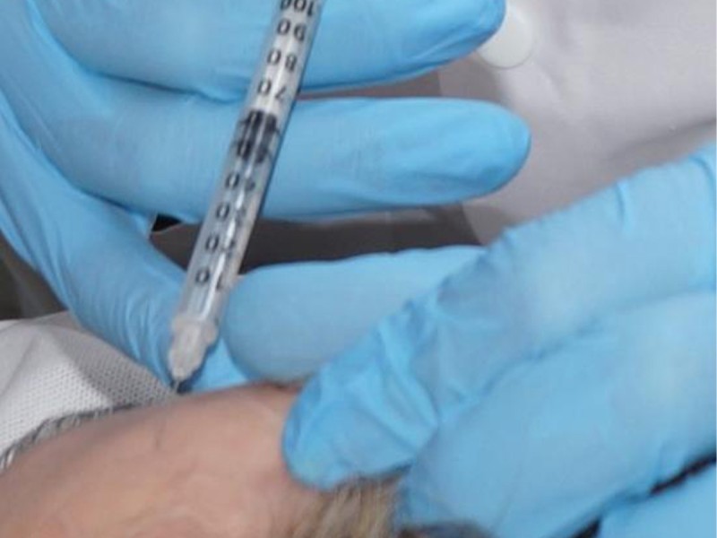 Redefineste-ti frumusetea - Mezoterapie, PRP si Botox in Bucuresti